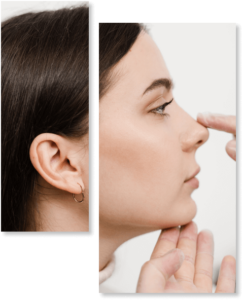 RINOPLASTIA - Sociedade Brasileira de Rinoplastia